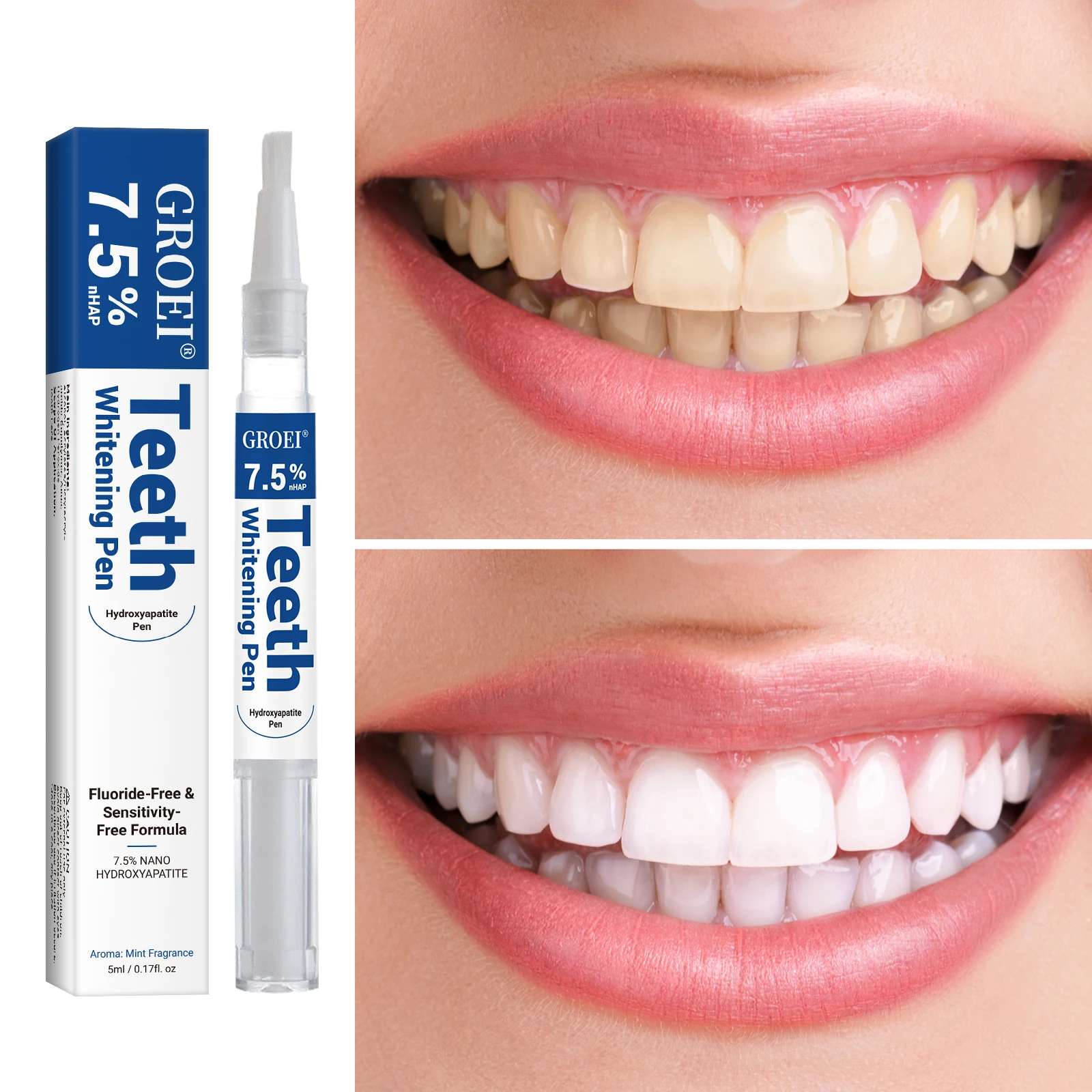 Penna per sbiancamento dei den - Teeth Whitening App recensione e prezzo