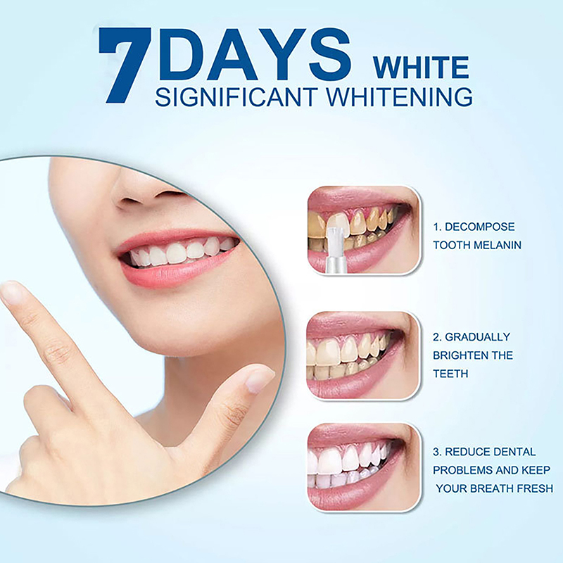 Penna Sbiancante per Denti, Ge - Teeth Whitening Bleaching Kit recensione e prezzo