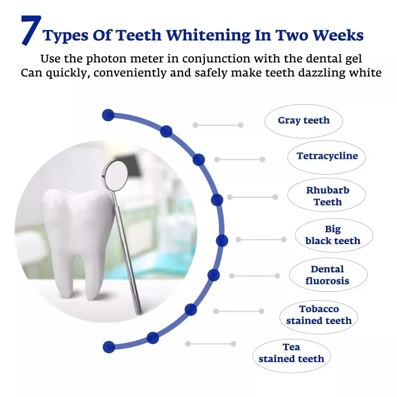 Dispositivo Intelligente di Sb - Teeth Whitening With Blue Light recensione e prezzo