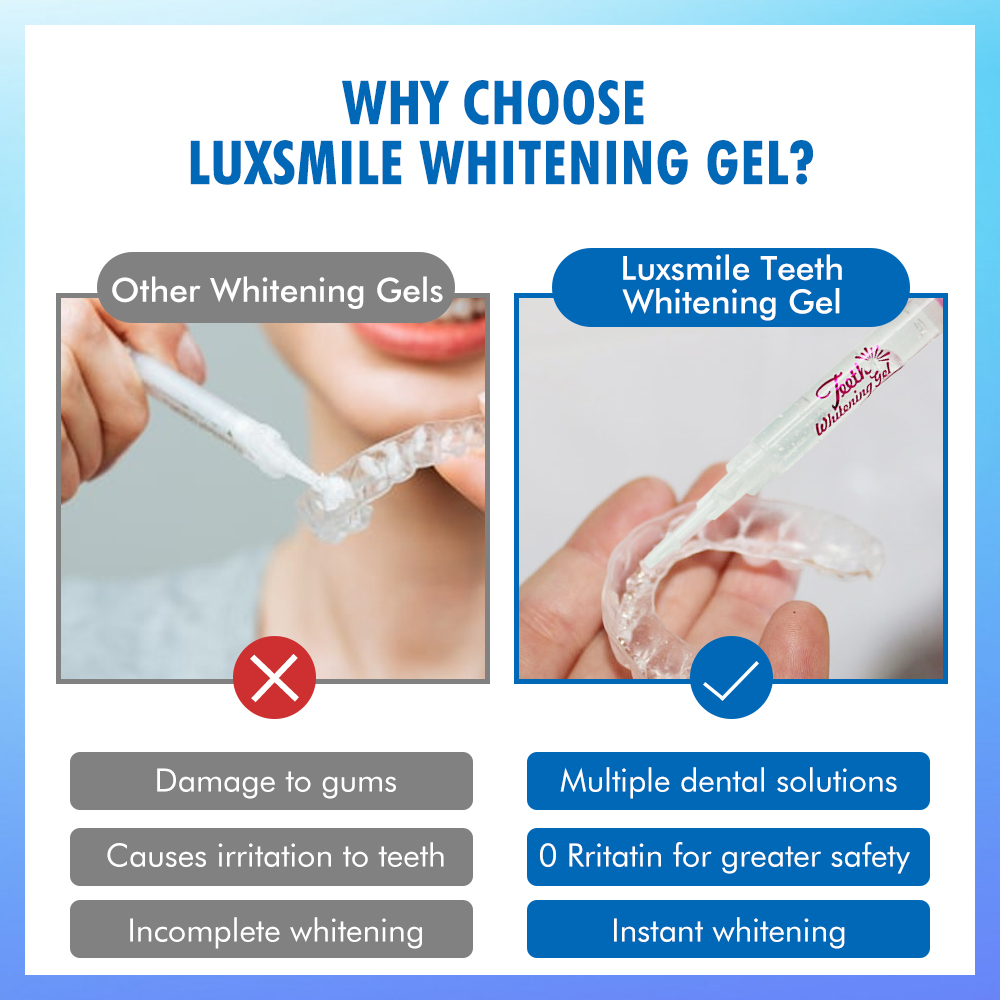 Gel sbiancante per denti PAP o - Teeth Whitening Bleaching Kit recensione e prezzo