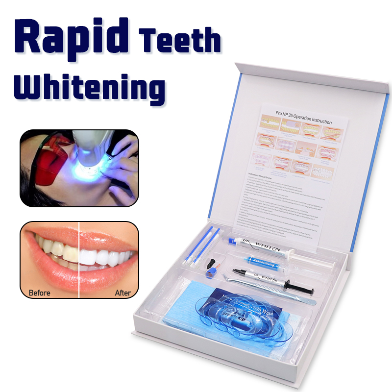 Kit professionale per sbiancam - Teeth Whitening Bleaching Kit recensione e prezzo