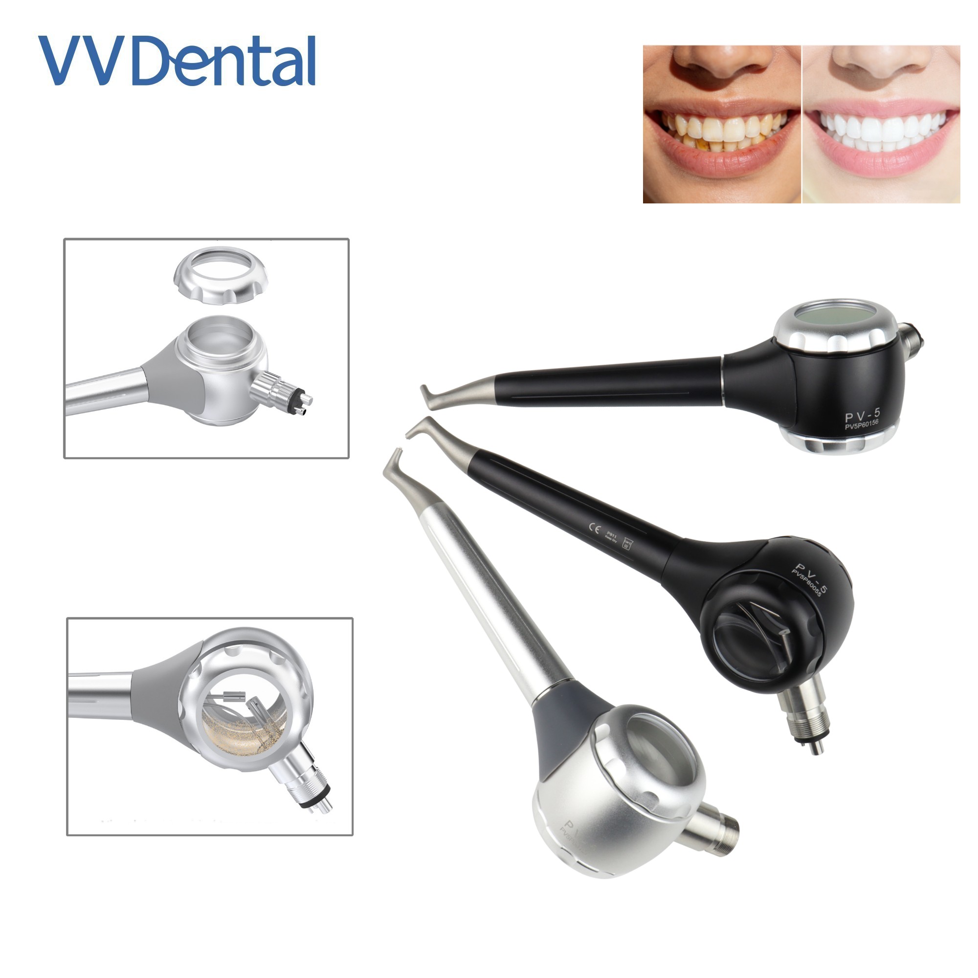 Pistola per Sabbiatura Dentale - Teeth Whitening China recensione e prezzo