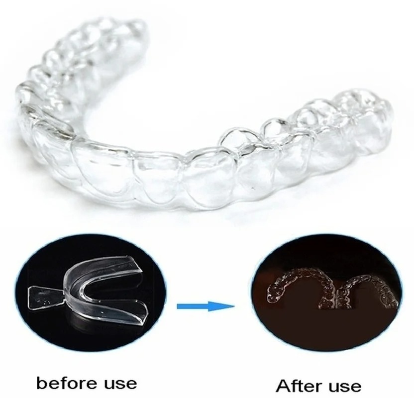 Anti Russare Bruxismo Dormire  - Teeth Whitening Mouth Guard recensione e prezzo