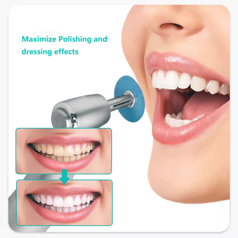 40 pz Dischi Per Lucidatura De - Teeth Whitening Home recensione e prezzo