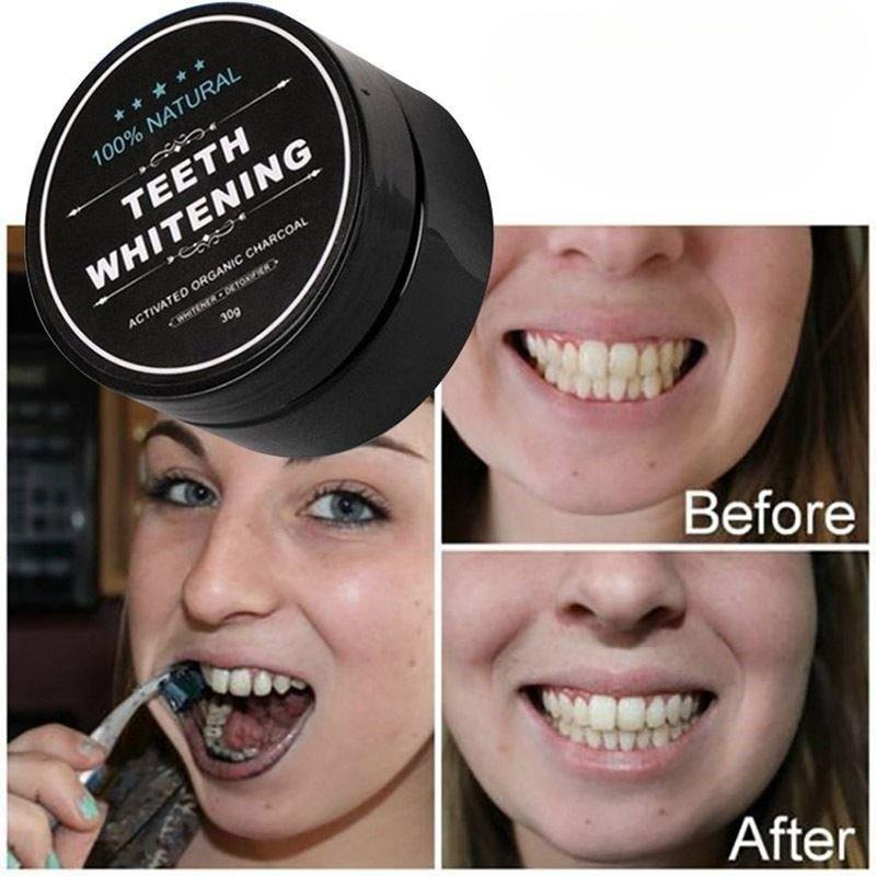 1 scatola di polvere per sbian - Teeth Whitening Filter recensione e prezzo