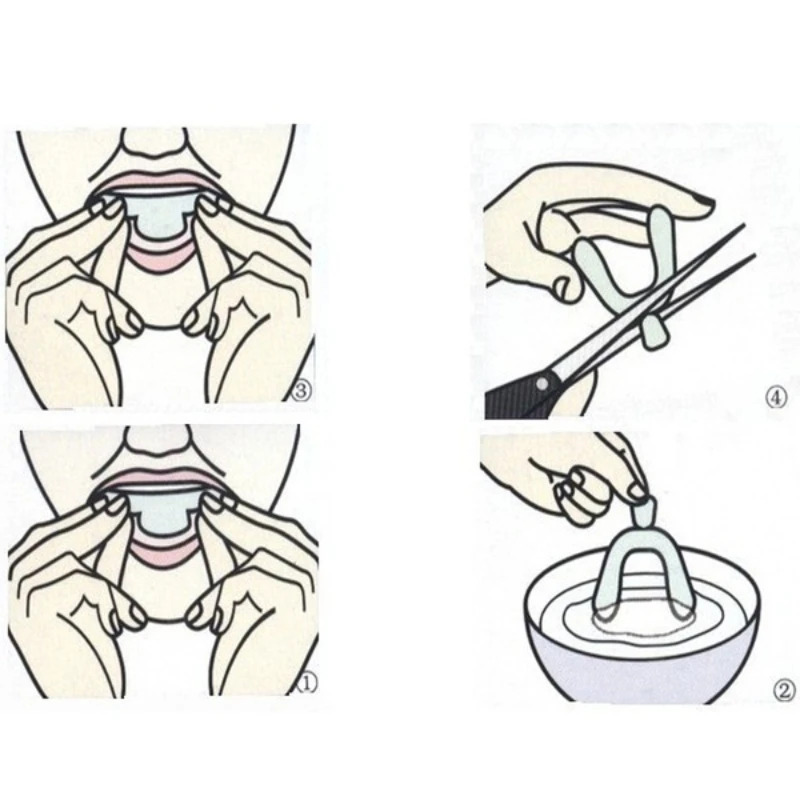 2/4/12PCS Anti Russare Dormire - Teeth Whitening Mouth Guard recensione e prezzo