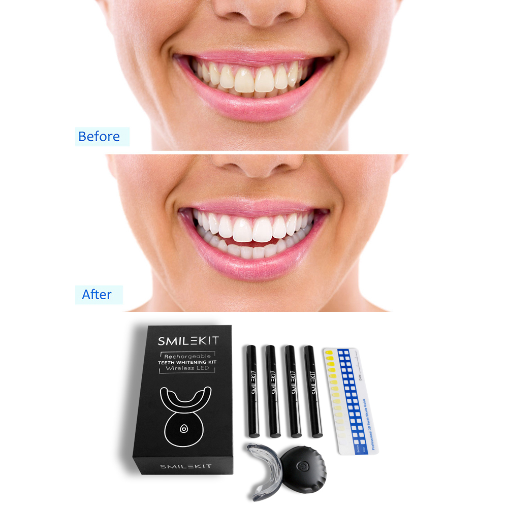 Nuovi kit di gel per sbiancame - Teeth Whitening Bleaching Kit recensione e prezzo