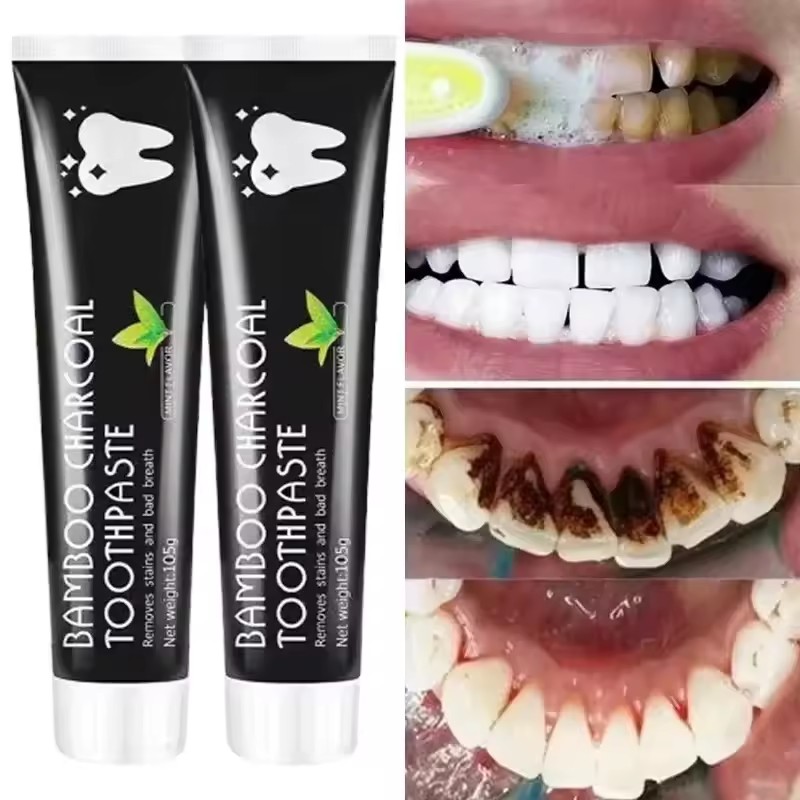 Dentifricio Sbiancante al Carb - Teeth Whitening Filter recensione e prezzo